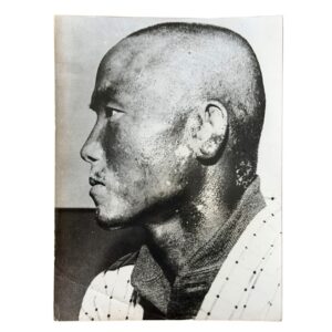 Home 8 Associated Press Telephoto of Tadashi Yamamoto Following Radiation Exposure from the Castle Bravo Hydrogen Bomb Test - 30 March 1954